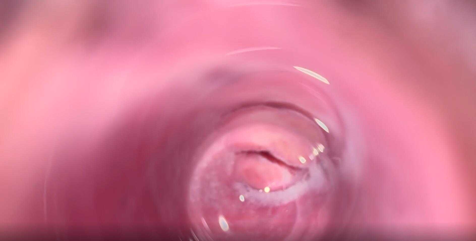 OnlyFans[Kinky Mia Foster]相机深入阴道-第2张图片-萌站